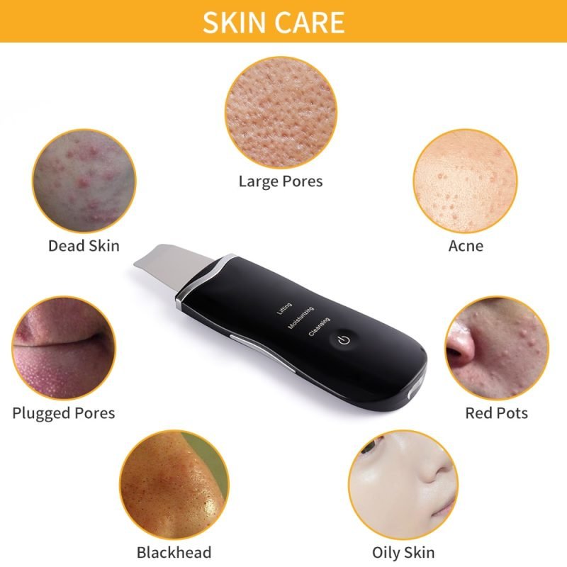 Ultrasound Face Skin Scrubber High-Frequency Vibration Facial Massager Face Lifting Blackhead Removal Skin Peeling Pores Cleaner - Image 2