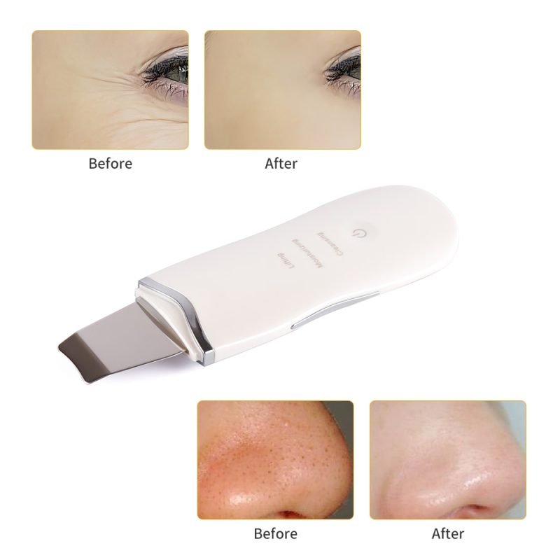 Ultrasound Face Skin Scrubber High-Frequency Vibration Facial Massager Face Lifting Blackhead Removal Skin Peeling Pores Cleaner - Image 5