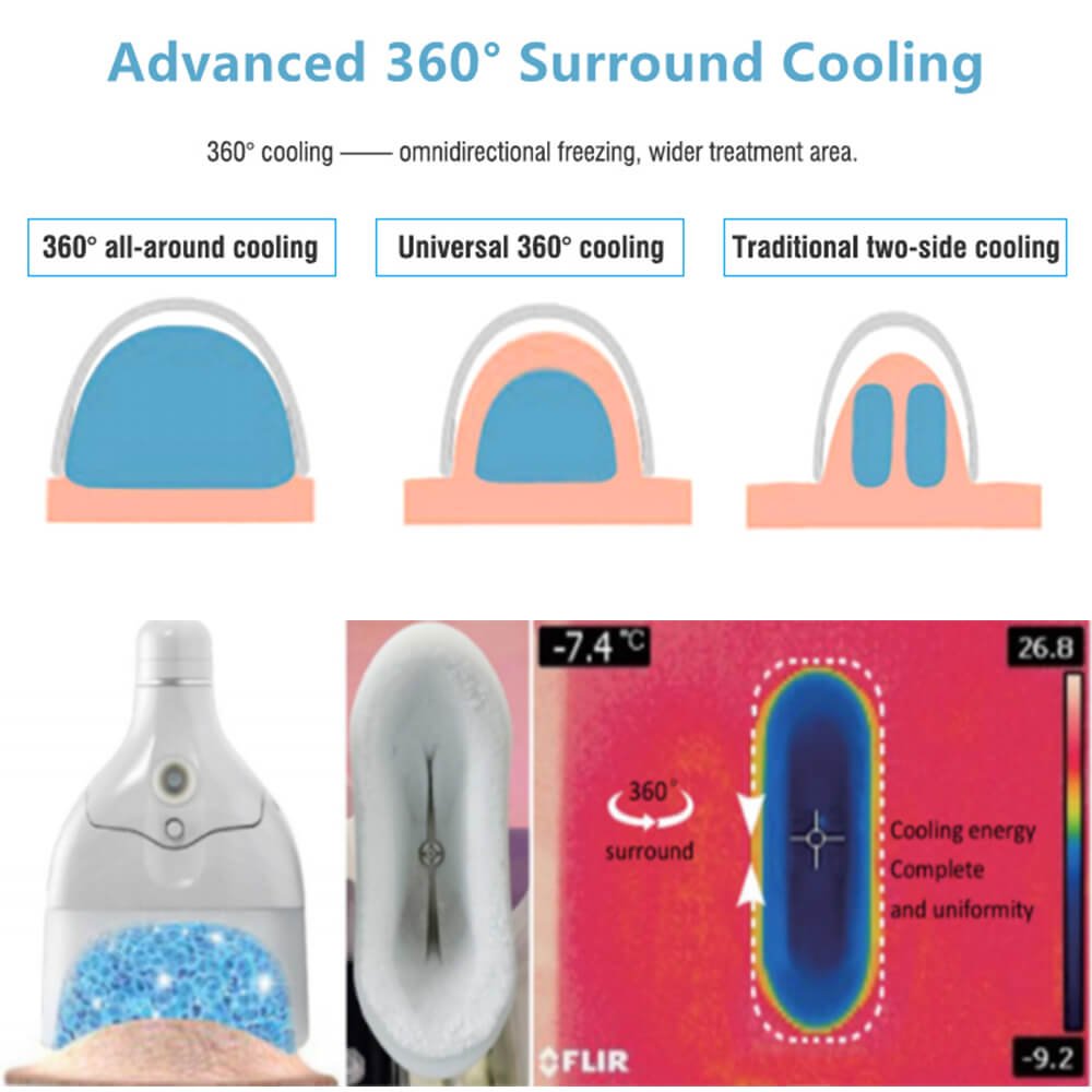 advanced 360 surround cooling