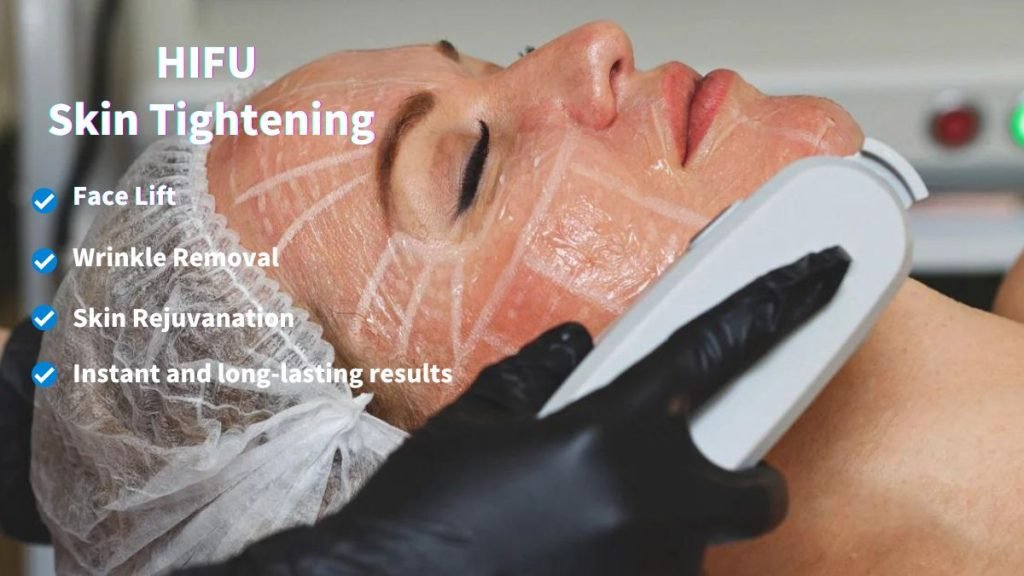 hifu skin tightening