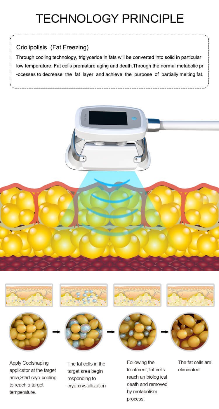 how does cryolipolysis work