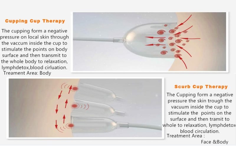 Butt Vacuum Therapy Machine Breast Enhancements Buttock Lift with Vacuum Suction Cups BBL - Image 10